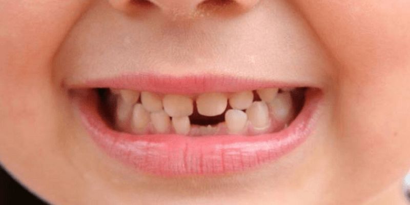 Ý nghĩa đằng sau điềm báo nằm mơ thấy rụng răng hàm dưới